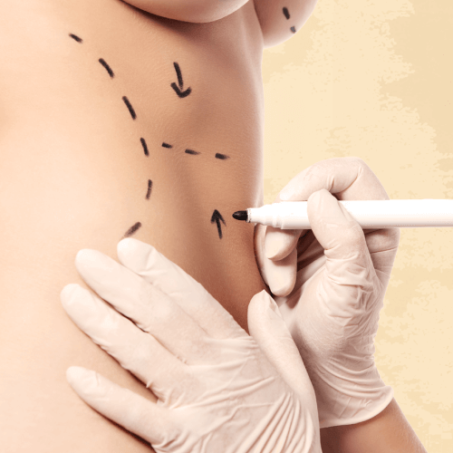 Advanced Body Contouring